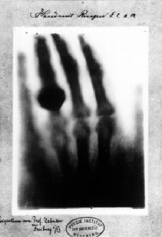 Descubrimiento de los rayos X por Wilhelm Roentgen en 1895