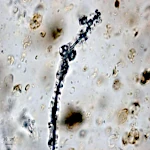 Las cianobacterias crean gases tóxicos