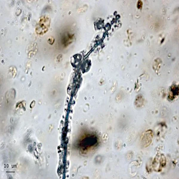 Cynaobacteria in resin